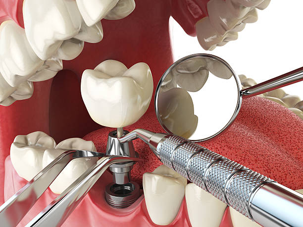 Dentist for Dental Trauma in OR